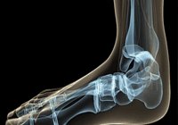Medical X-ray of foot anatomy